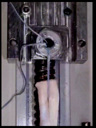 Animated demonstration of cheese-wiring effect — suture cutting through tendon tissue under tension