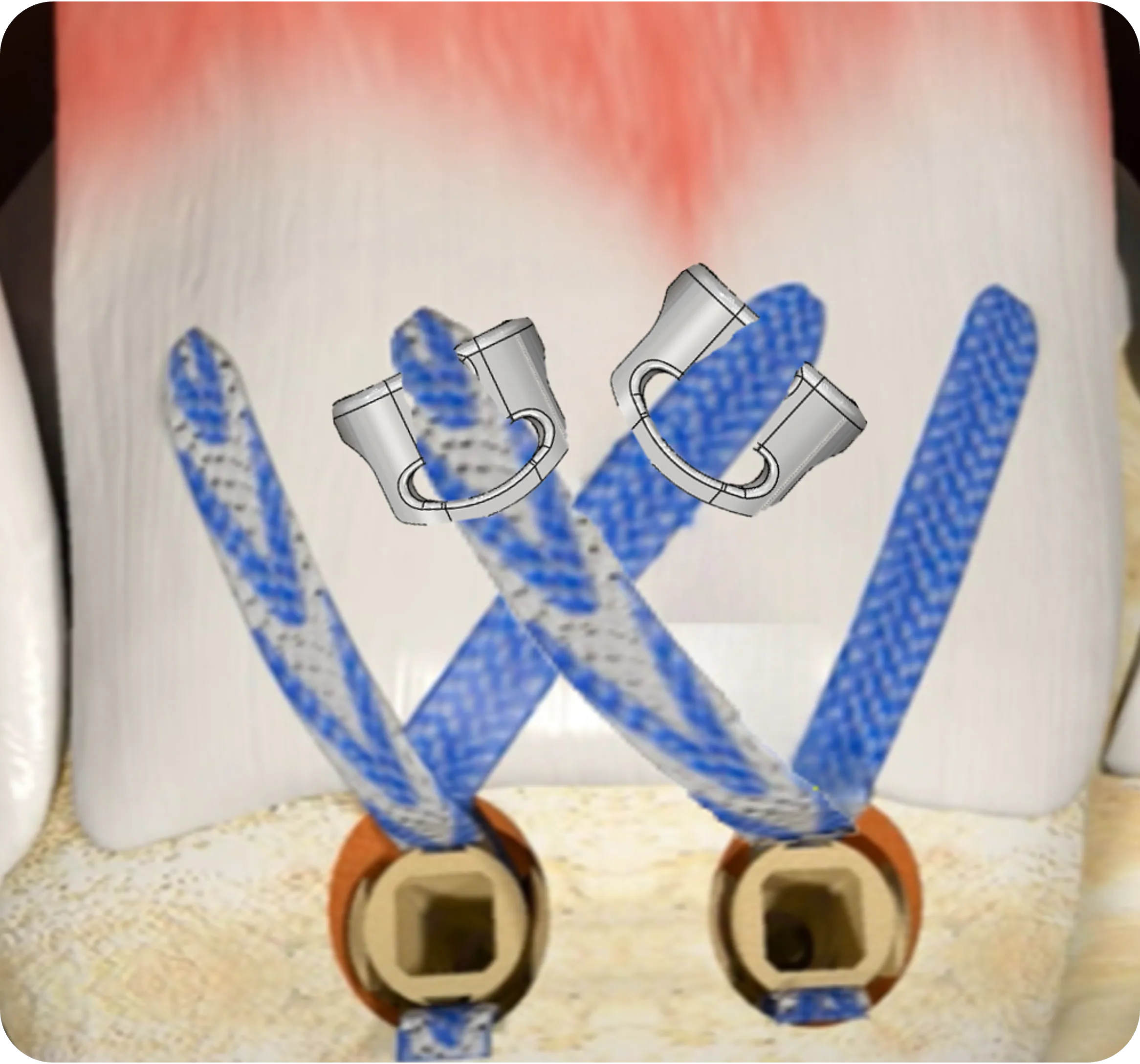 Knotless Double Row with TENOGARDE™