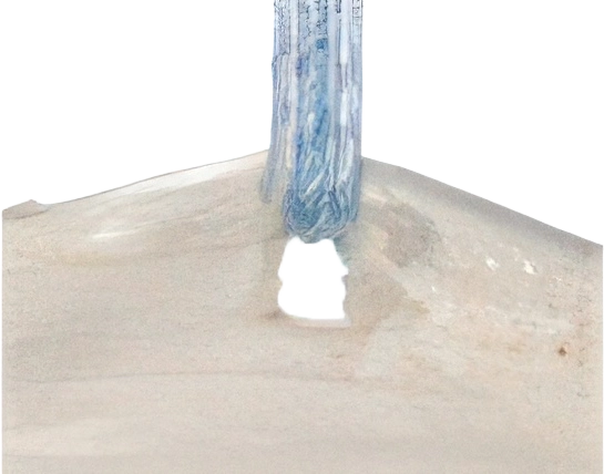 Close-up of suture pulling through tendon tissue at the suture-tendon interface